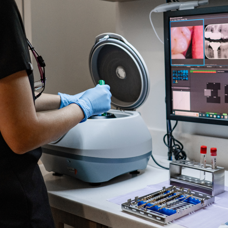 PRF (Platelet-Rich Fibrin) therapy preparation process for enhanced healing after wisdom teeth removal